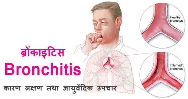 bronchitis-bronchitis-in-hindi